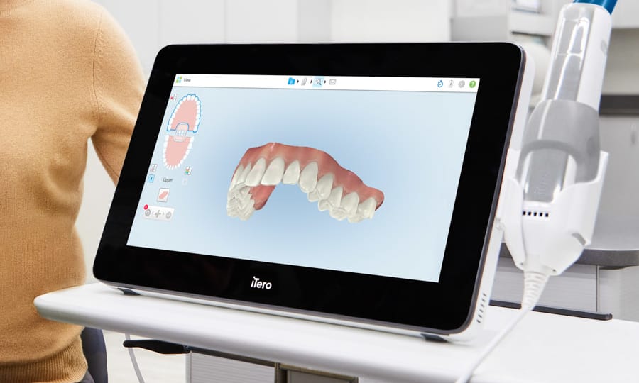 A screen shows a digital rendering of an upper row of teeth.
